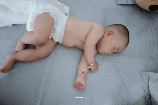 林州宝宝头上长痱子